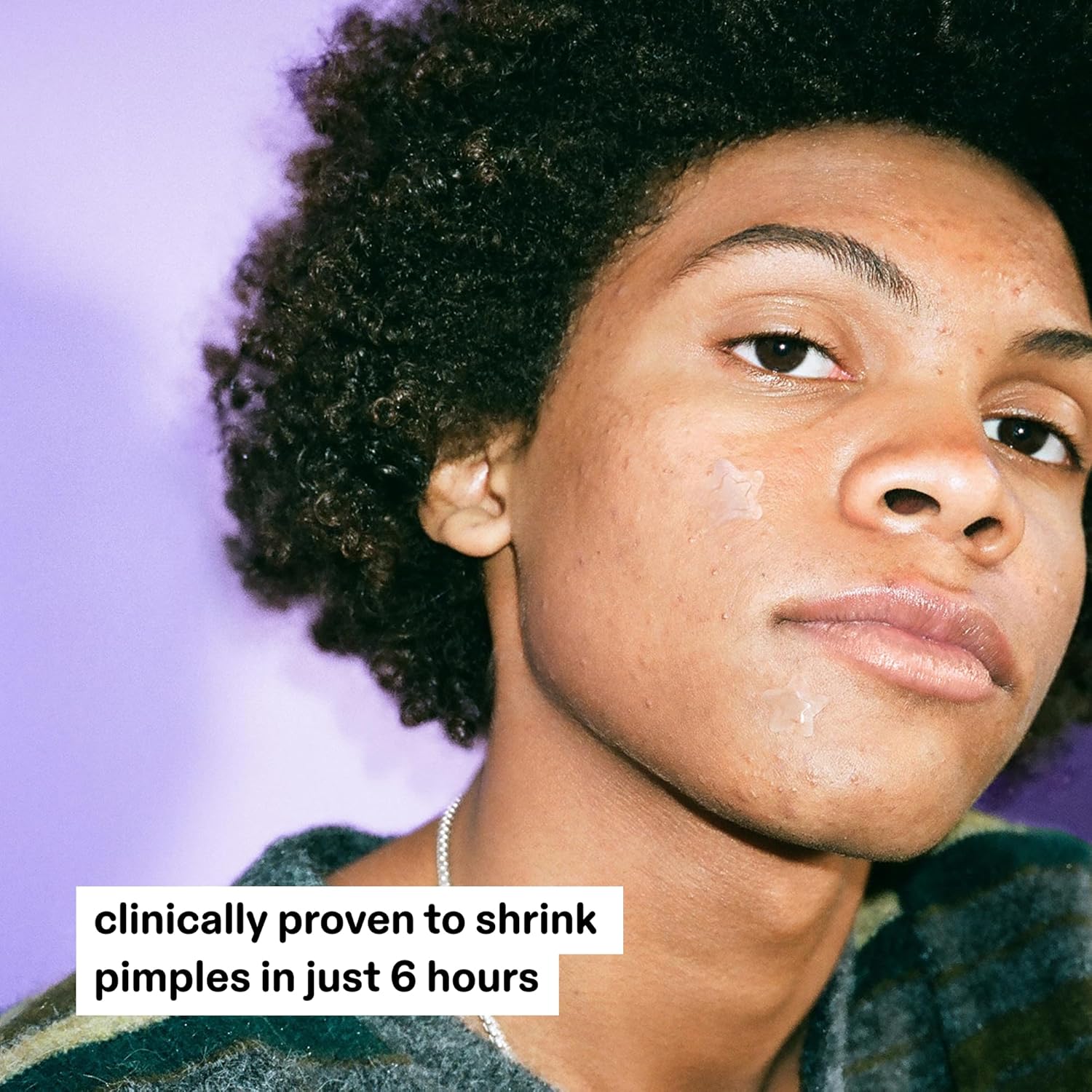 Starface Hydro-Star Recovery Patches BIG PACK, Hydrocolloid Patches with Aloe Vera and Vitamin A, Helps Soothe and Protect Skin After Picking, Shrinks Spots, Vegan, Cruelty-Free Skincare (96 Count)